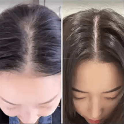 Immagine before and after 2