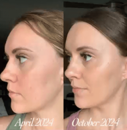Immagine before and after 3