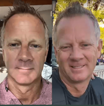 Immagine before and after 4