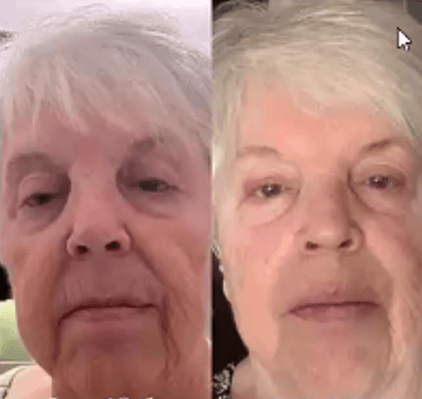 Immagine before and after 5