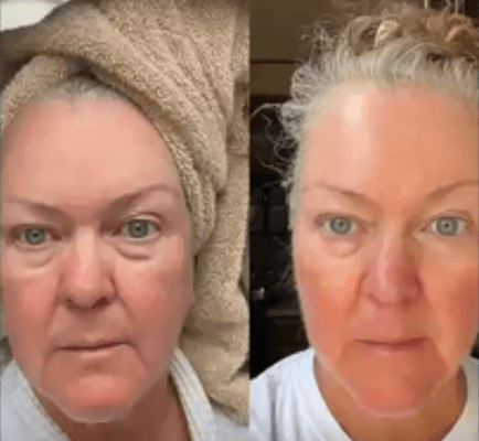 Immagine before and after 6