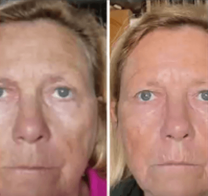 Immagine before and after 7