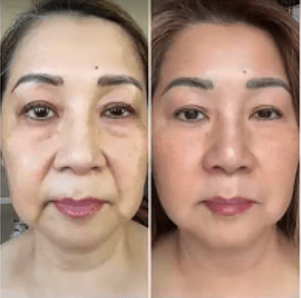 Immagine before and after 8