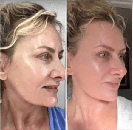 Immagine before and after 9