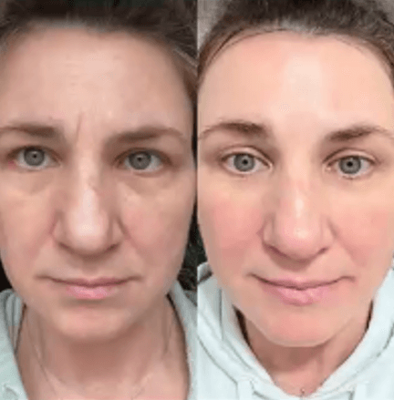 Immagine before and after 10