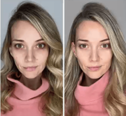Immagine before and after 12
