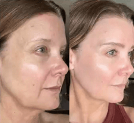 Immagine before and after 13