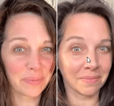 Immagine before and after 14