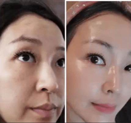 Immagine before and after 15