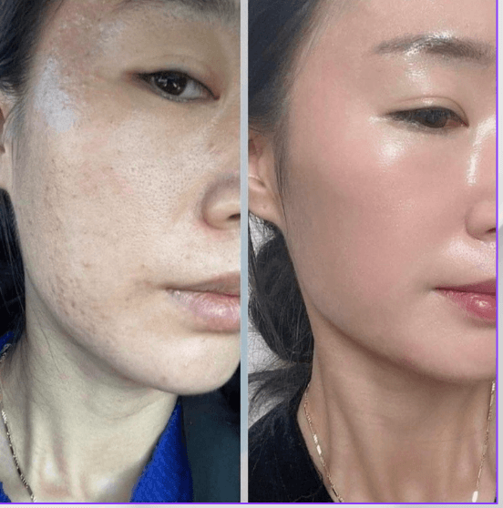 Immagine before and after 16