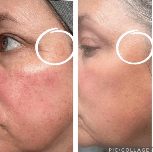 Immagine before and after 17