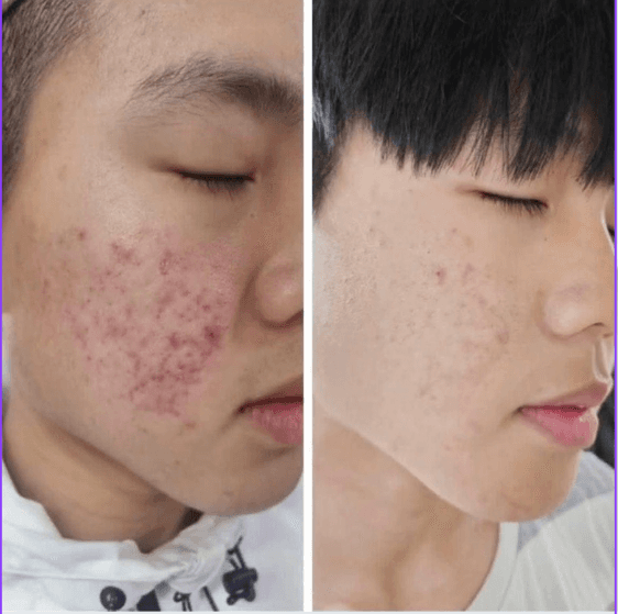 Immagine before and after 18