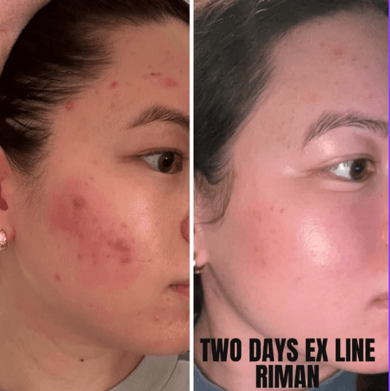Immagine before and after 19