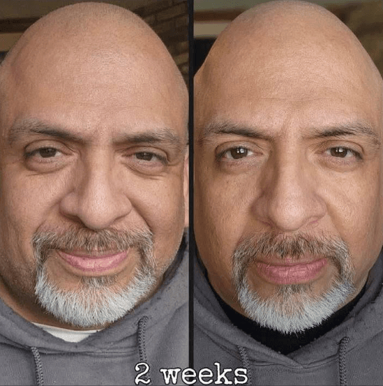 Immagine before and after 20